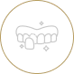 الفينير
