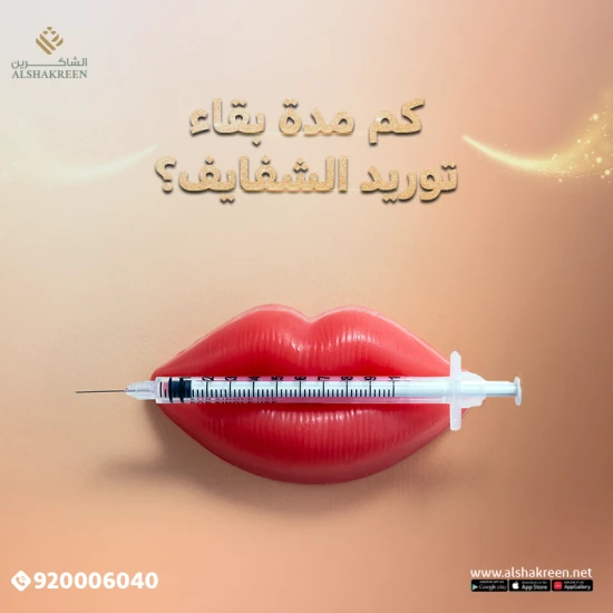 كم مدة بقاء توريد الشفايف؟