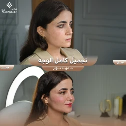 <p>د. مها نوار&nbsp;<br />
<br />
تجميل كامل الوجه</p>