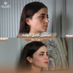 <p>تجميل كامل الوجه&nbsp;</p>