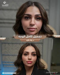 <p>تجميل كامل الوجه&nbsp;</p>