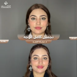 <p>تجميل كامل الوجه&nbsp;</p>