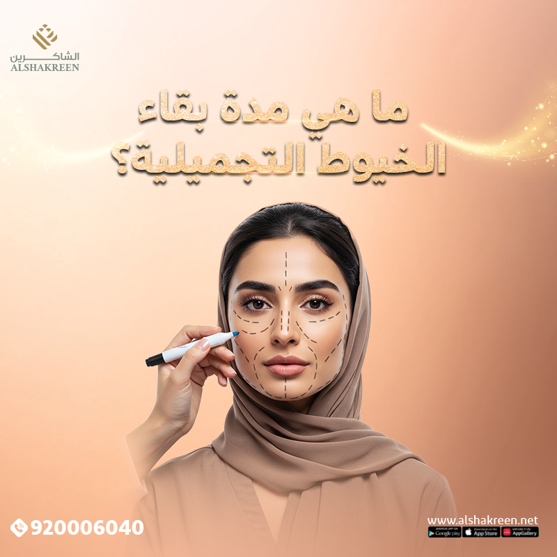 الخيوط التجميلية