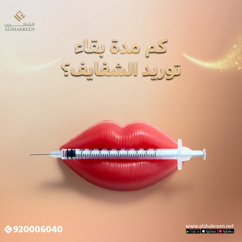 مدة بقاء توريد الشفايف