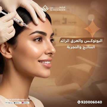 البوتوكس والعرق الزائد: النتائج والتجربة