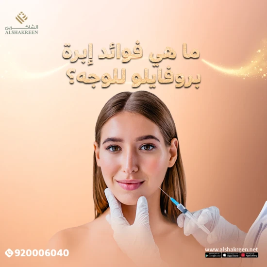 What are the benefits of Profhilo facial needle?