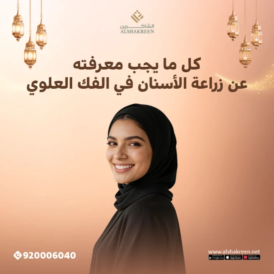 زراعة الأسنان الفورية: الحل المثالي لابتسامة طبيعية