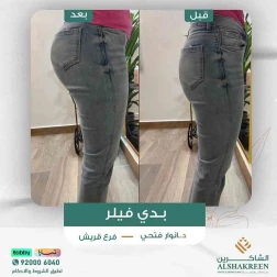 <p>بدي فيلر</p>