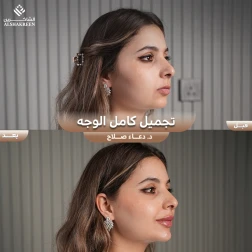 <p>تجميل كامل الوجه&nbsp;</p>