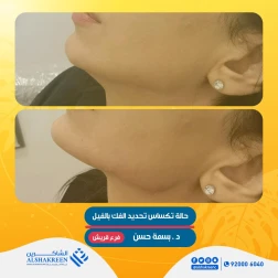 <p><a href="https://alshakreen.net/public/ar/offers/%D8%B9%D8%B1%D9%88%D8%B6-%D8%A7%D9%84%D8%AA%D8%AC%D9%85%D9%8A%D9%84-22?page=1">حالة تكساس تحديد فك بالفيلر</a></p>