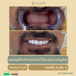 <p>تركيبات متحركة باستخدام الفيليبس<br />
د/ هبه رفعت&nbsp;<br />
فرع الجامعه&nbsp;</p>